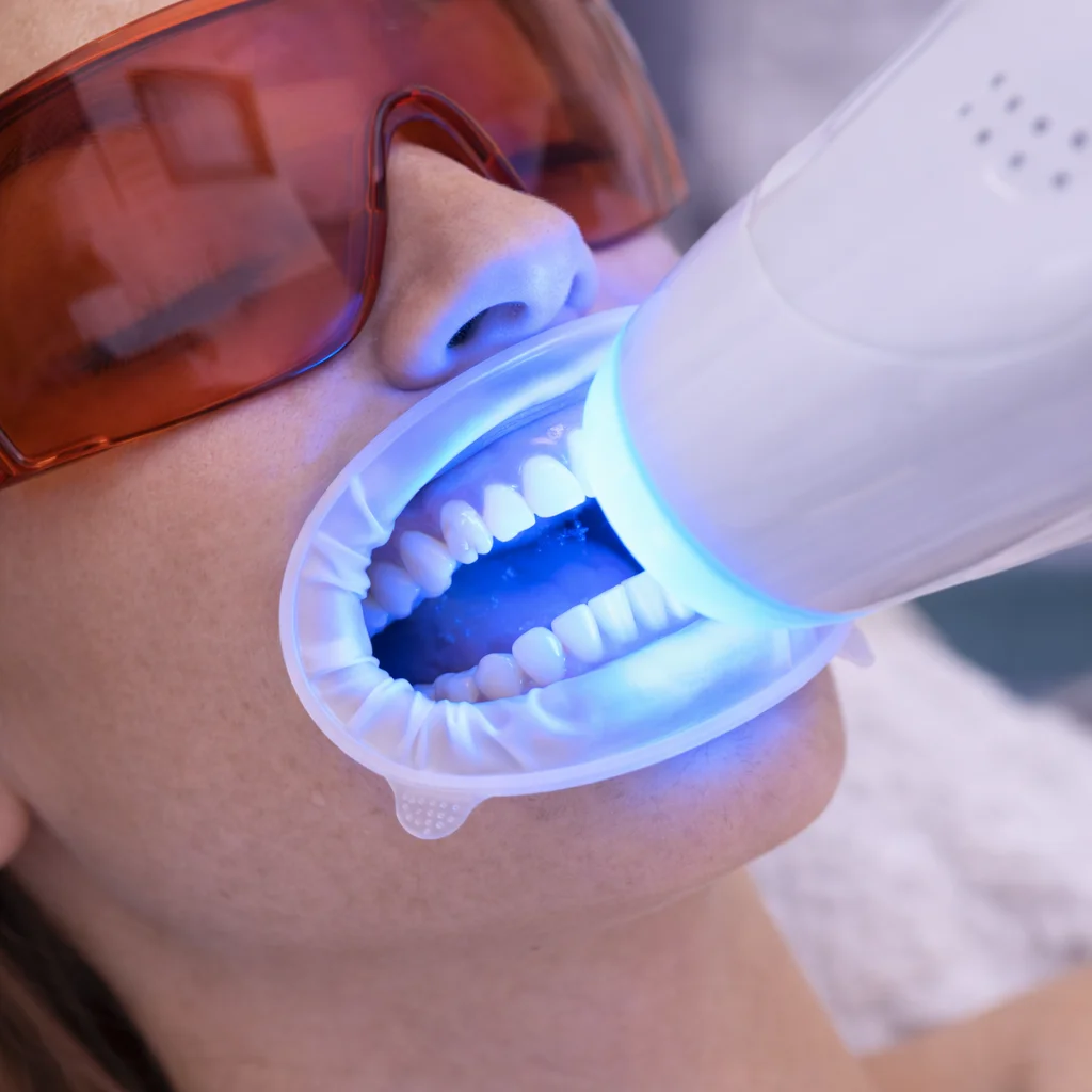 Teeth whitening treatment