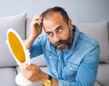 Low confidence due to hair loss