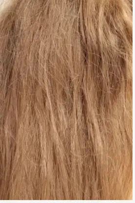 Hair breakage and split ends