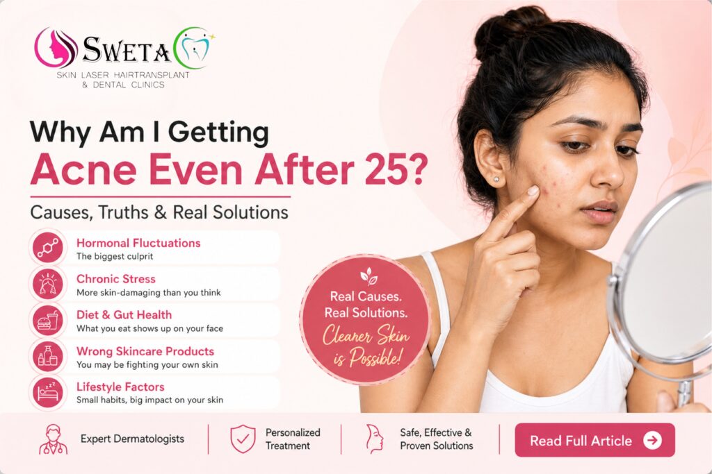 Why Am I Getting Acne Even After 25 Causes, Truths & Real Solutions - Sweta Clinics
