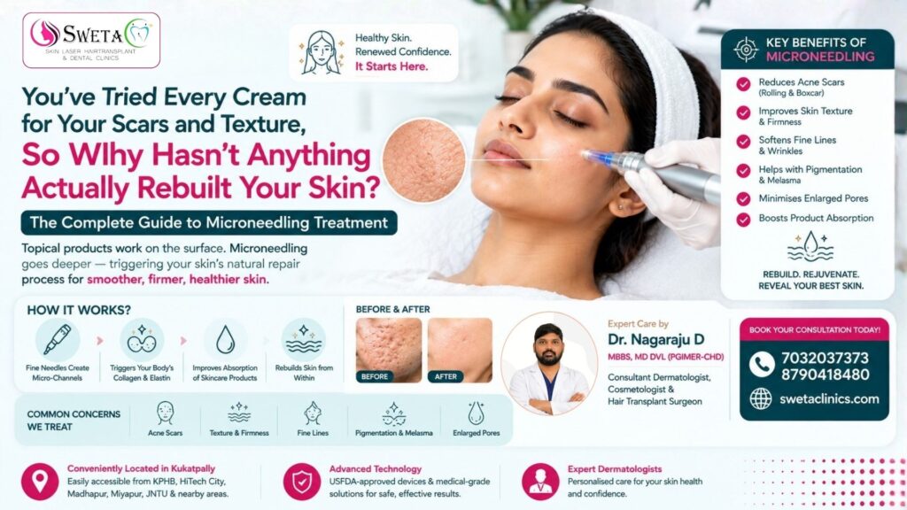 Microneedling Treatment Near Me in Kukatpally | Sweta Clinics